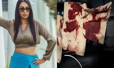 बाल-बाल बची कश्मीरा शाह, भगवान को धन्यवाद देते हुए बोलीं- 'आपने मुझे बचा लिया'