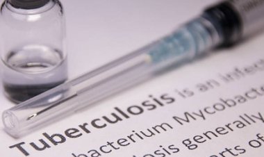 योगी सरकार की पहल: टीबी रोगियों के परिवारों की हर तीन माह में होगी जांच