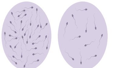 क्या है पुरुषों में कम शुक्राणु संख्या के कारण: जीवनशैली, बीमारी और अन्य समस्याएं