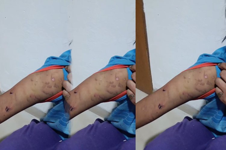 Noida : नाबालिग नौकरानी को पीटा, बच्ची को पुलिस ने कराया मुक्त, मुकदमा दर्ज