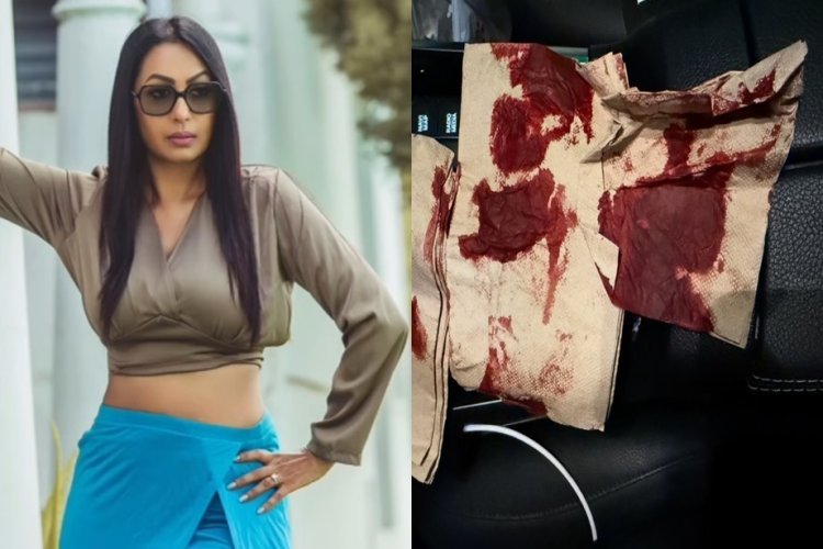 बाल-बाल बची कश्मीरा शाह, भगवान को धन्यवाद देते हुए बोलीं- 'आपने मुझे बचा लिया'