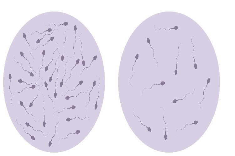 क्या है पुरुषों में कम शुक्राणु संख्या के कारण: जीवनशैली, बीमारी और अन्य समस्याएं
