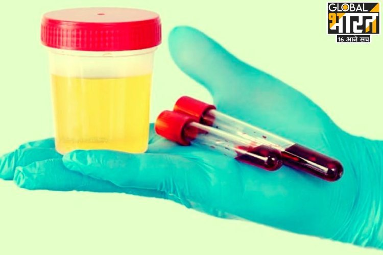 पेशाब में खून आए तो न करें नजरअंदाज, हो सकती है ये बीमारियां... तुरंत लें डॉक्टर की सलाह