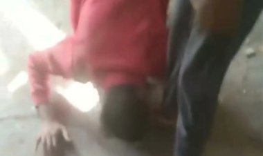 UP में बाल कटवाने को लेकर दलित छात्र की बेरहमी से पिटाई, हाथ हुआ फ्रैक्चर, सिर में लगी चोट,  8 शिक्षकों पर दर्ज हुई FIR