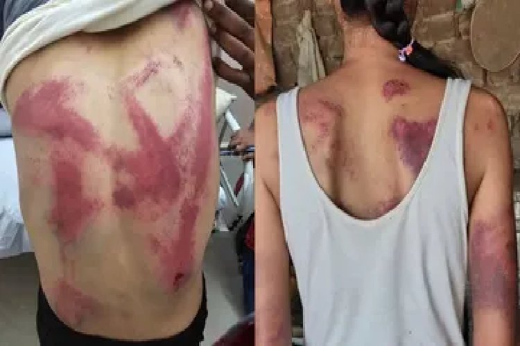 मंदिर के लाउडस्पीकर की शिकायत पर महिला वकील को बुरी तरह पीटा, पीड़िता ने तस्वीरें शेयर कर बयां किया दर्द!