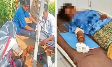 सीता की तरह महिला को देनी पड़ी अग्निपरीक्षा, दो बच्चों की मां ने खौलते तेल में डाल दिया हाथ