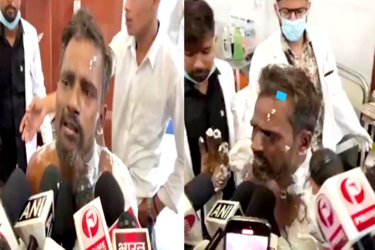 दानिश, वसीम व नाजिम से परेशान होकर योगेंद्र ने सपा कार्यालय के बाहर की आत्मदाह की कोशिश, 80 फीसदी जला, कहा- तीनों ने मिलकर....