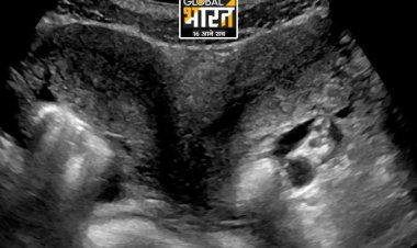 2 प्राइवेट पार्ट होने की वजह से परेशान थी युवती, भगवान बनकर खड़े हुए UP के इस अस्पताल के डॉक्टर्स!