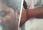 मुस्लिम दोस्त की पत्नी के साथ घूम रहे हिंदू युवक पर भीड़ ने किया हमला, पीट-पीटकर किया अधमरा