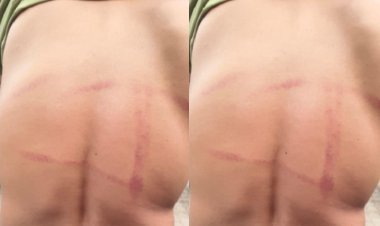 गोरखपुर में पति-पत्नी के विवाद को सुलझाने के नाम पर दरोगा ने मांगी 50 हजार की रिश्वत, नहीं देने पर किया लहूलुहान