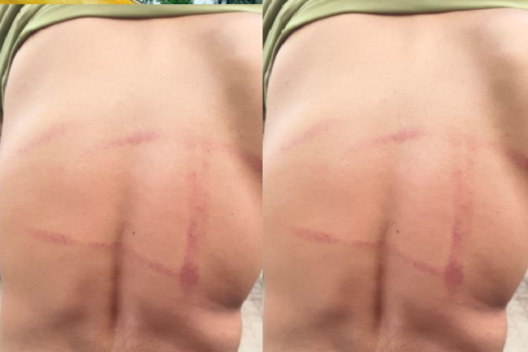 गोरखपुर में पति-पत्नी के विवाद को सुलझाने के नाम पर दरोगा ने मांगी 50 हजार की रिश्वत, नहीं देने पर किया लहूलुहान