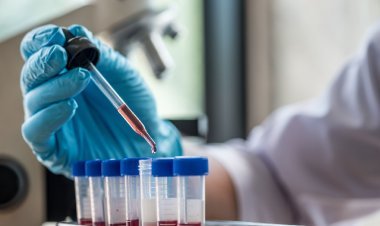 युवती ने शादी से किया इनकार तो, HIV संक्रमित इजेंक्शन घोंपकर फरार हुआ मंगेतर