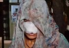 उत्तर प्रदेश के हमीरपुर में पति ने झगड़े के बाद पत्नी की नाक और गाल काट खाए; पत्नी के चेहरे पर लगे 10 टांके