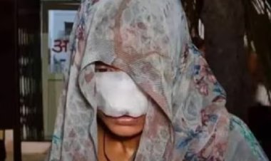 उत्तर प्रदेश के हमीरपुर में पति ने झगड़े के बाद पत्नी की नाक और गाल काट खाए; पत्नी के चेहरे पर लगे 10 टांके