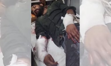 दिल्ली में बकाया विवाद ने लिया खौफनाक मोड़: हलवाई को बांधकर ग्राइंडर से हाथ काटने का आरोप