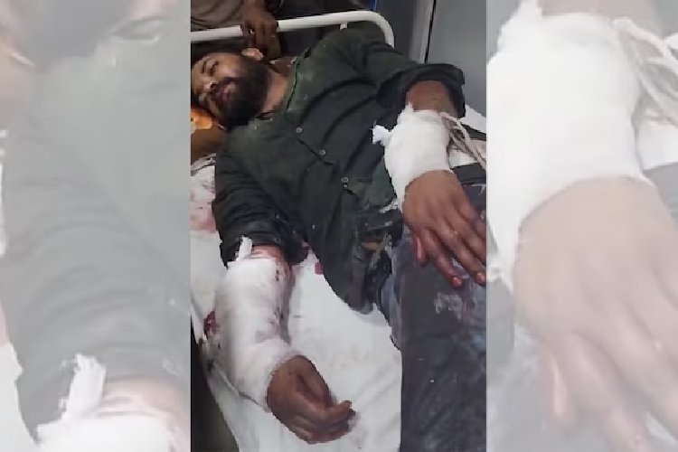 दिल्ली में बकाया विवाद ने लिया खौफनाक मोड़: हलवाई को बांधकर ग्राइंडर से हाथ काटने का आरोप