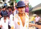 अंडे फेंके, पत्थर उठाया और सीधे चेहरे पर मारा... टीएमसी ने अभिषेक बनर्जी पर हुए हमले का वीडियो किया जारी