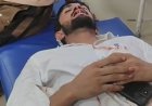 हाथरस में बाइक सवार बदमाशों का तांडव, युवक पर सरेआम झोंका फायर; होंठ को छूकर निकली गोली, हालत गंभीर
