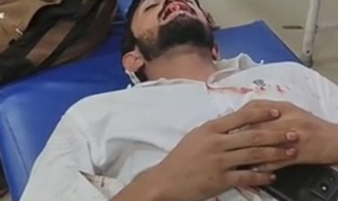 हाथरस में बाइक सवार बदमाशों का तांडव, युवक पर सरेआम झोंका फायर; होंठ को छूकर निकली गोली, हालत गंभीर