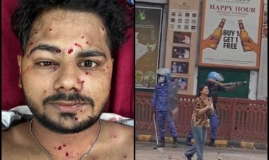1 कारतूस में 600 छर्रे, 1000 फीट/सेकंड की रफ्तार: जानिए कितनी घातक होती है प्रदर्शनों पर भारी पड़ने वाली 'पैलेट गन'?