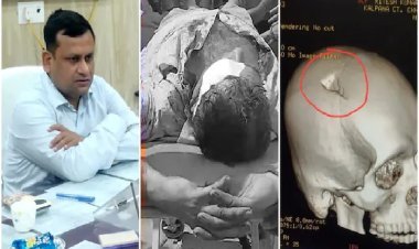 NEET प्रदर्शन में बर्बर हमला! BDO के सिर पर लोहे से वार, खोपड़ी फट गई...वीडियो वायरल