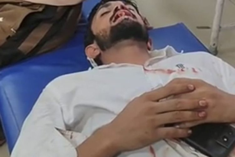 हाथरस में बाइक सवार बदमाशों का तांडव, युवक पर सरेआम झोंका फायर; होंठ को छूकर निकली गोली, हालत गंभीर
