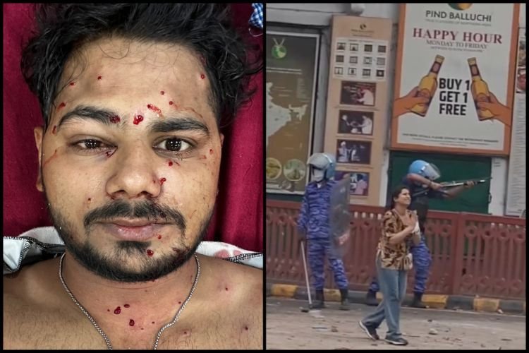1 कारतूस में 600 छर्रे, 1000 फीट/सेकंड की रफ्तार: जानिए कितनी घातक होती है प्रदर्शनों पर भारी पड़ने वाली 'पैलेट गन'?