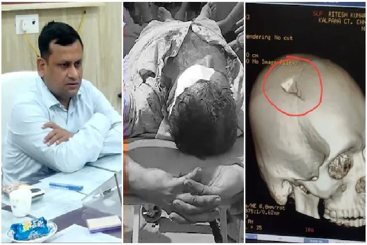 NEET प्रदर्शन में बर्बर हमला! BDO के सिर पर लोहे से वार, खोपड़ी फट गई...वीडियो वायरल