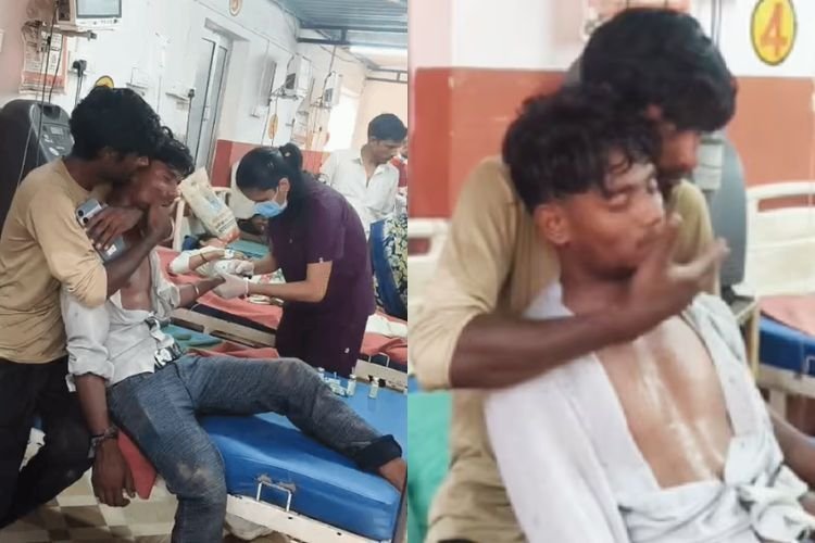 हरदोई में जहरीले सांप के डसने के बाद भाई ने दिखाई गजब की सूझबूझ: बेहोशी से बचाने के लिए जड़े 150 से ज्यादा थप्पड़, बची जान