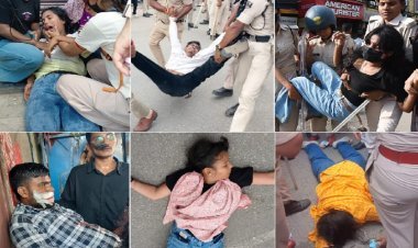 पटना में भारी बवाल: एसपी हुए घायल, पुलिस ने दौड़ा-दौड़ाकर पीटा, छात्र-छात्राएं बेहोश