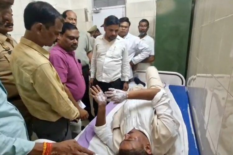 मोदी के सेवा संकल्प को लेकर निकली ज्योति यात्रा, अचानक भड़की आग, झुलस गए बीजेपी विधायक
